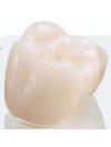 3M Paedodontic Zirconia Crowns Refill